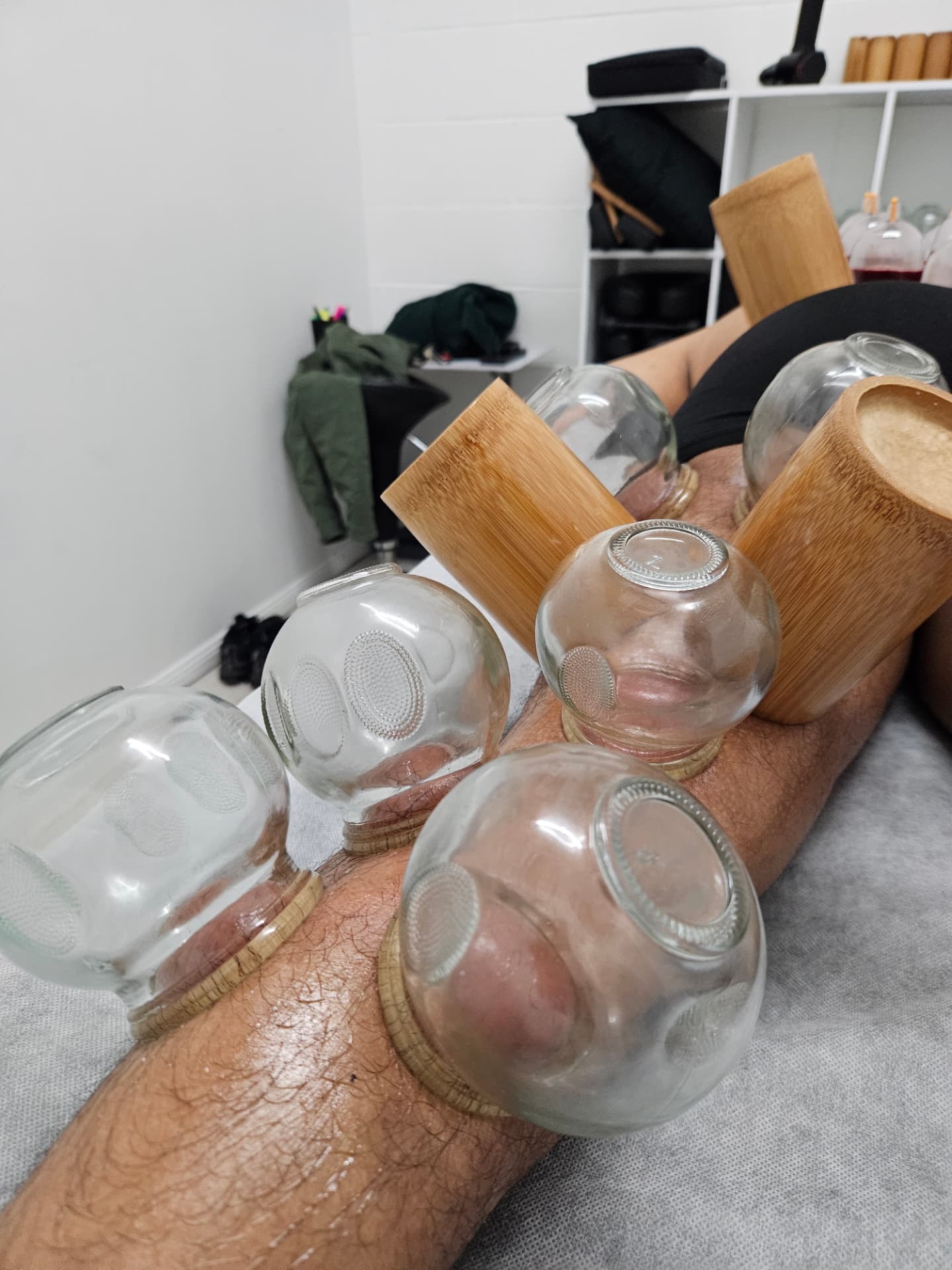 Glass and bamboo cups applied along a male client's leg